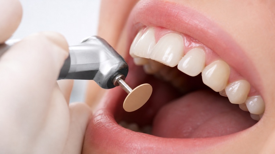 Aesthetic fillings