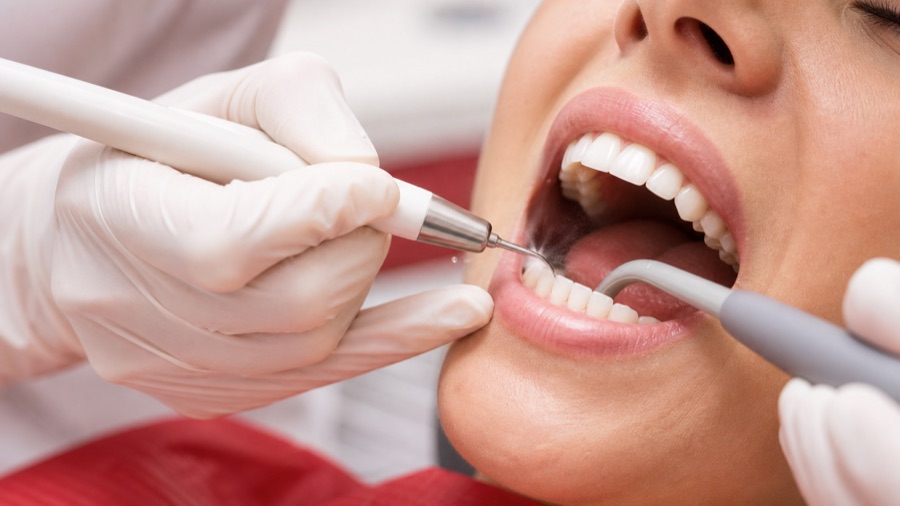 Scaling and polishing dental cleaning